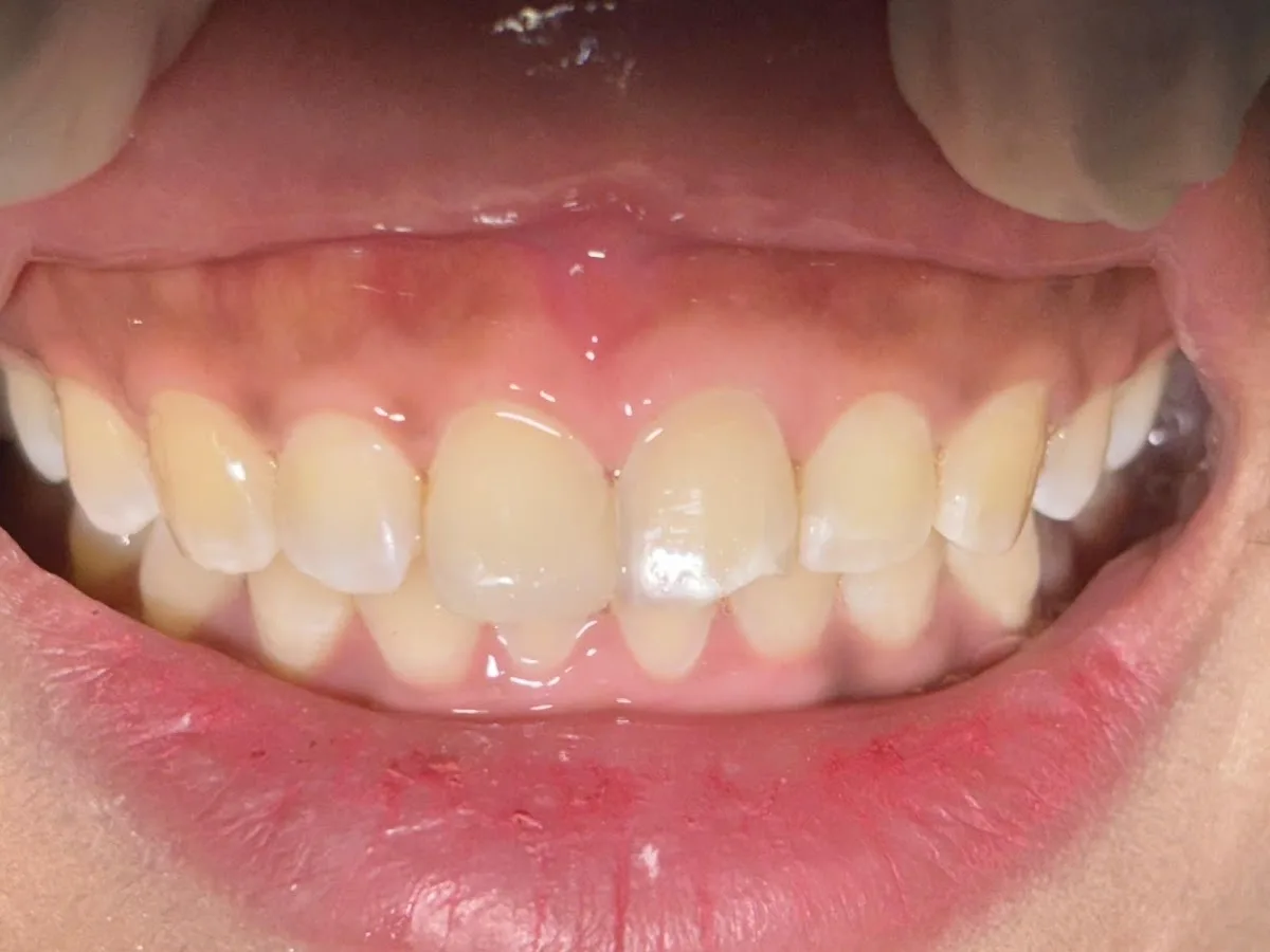 Happy teeth 2 dental surgery